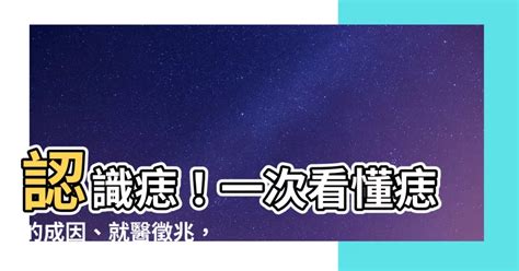 身體 痣|痣是什麼？一次了解痣原因、就醫時機以及如何改善